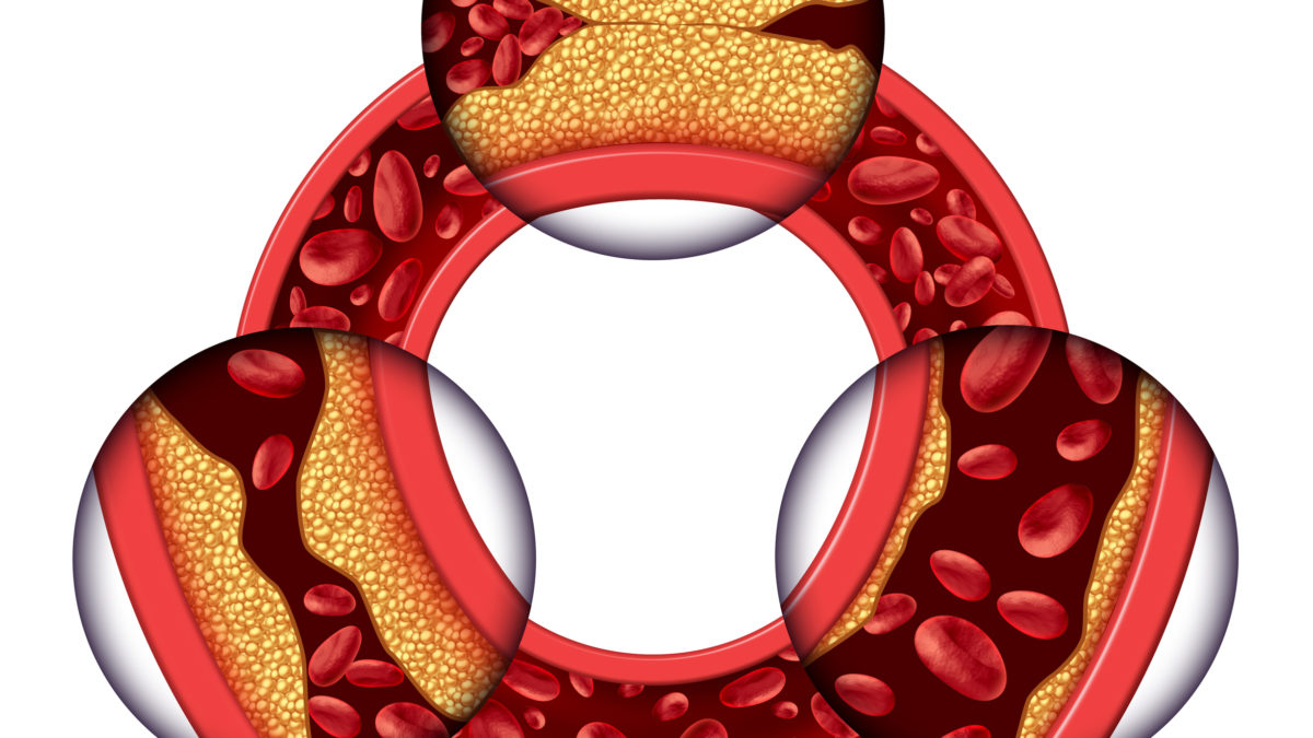 cholesterol 1200x675 1