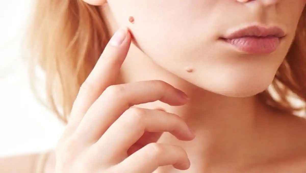 Moles