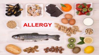 food allergies