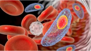toxoplasmosis2