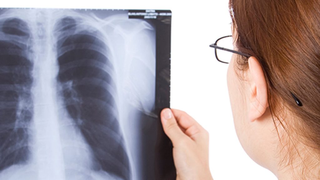 Doctor viewing xray 1200x675 1