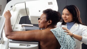 AI could help radiologists detect more cancers on mammogram images