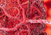 په وینه کې د TLC بشپړ جوړښت؛ روغتیایي معلومات