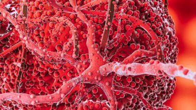 په وینه کې د TLC بشپړ جوړښت؛ روغتیایي معلومات