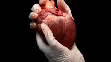 پر شخصیت د بدن د غړو د پیوند اغېز؛ ایا نوي غړي زموږ هویت بدلولی شي؟